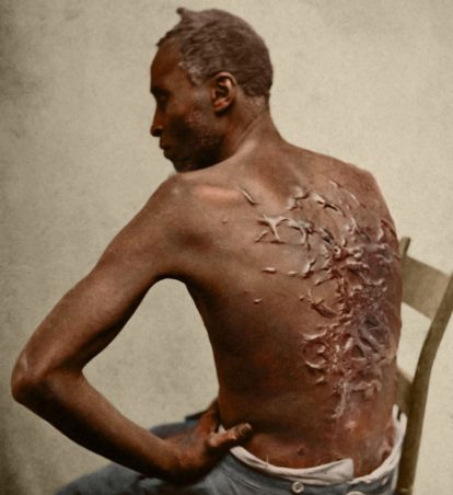  The Scourged Back 1863 - Tom Marshall (PhotograFix)